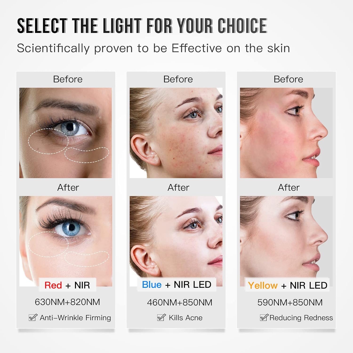 Thumbnail 1 de IBORRIA Máscara LED de Terapia Lumínica Facial 🌟