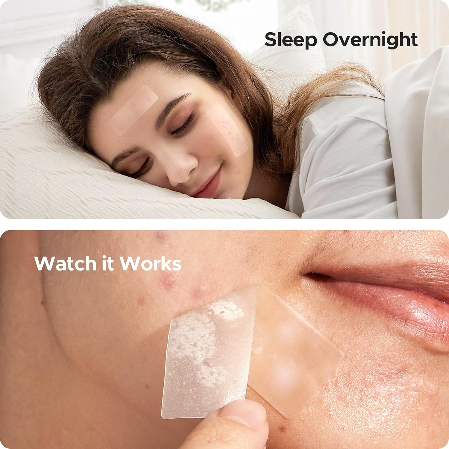 Thumbnail 6 de TKTK 60 mm XL Acne Patches 265 Pack
