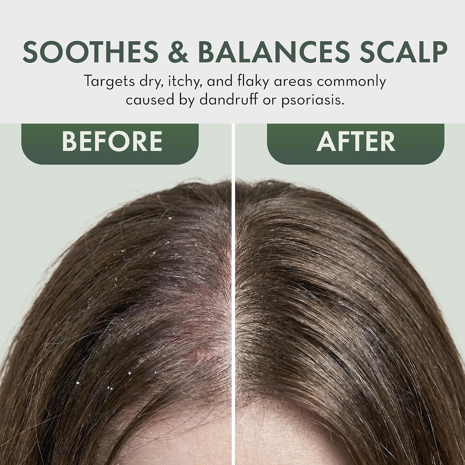 Thumbnail 4 de Pharm to Table Tea Tree Oil Leave-In Conditioner Spray, 8 fl oz