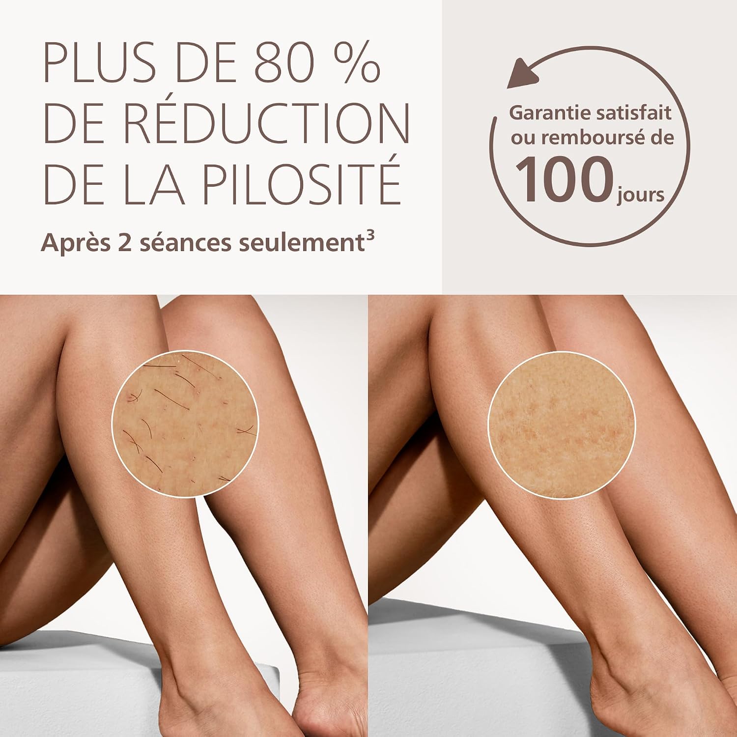 Detalle de Philips Lumea 9000 BRI938/00 IPL-ontharingsapparaat met 3 opzetstukken