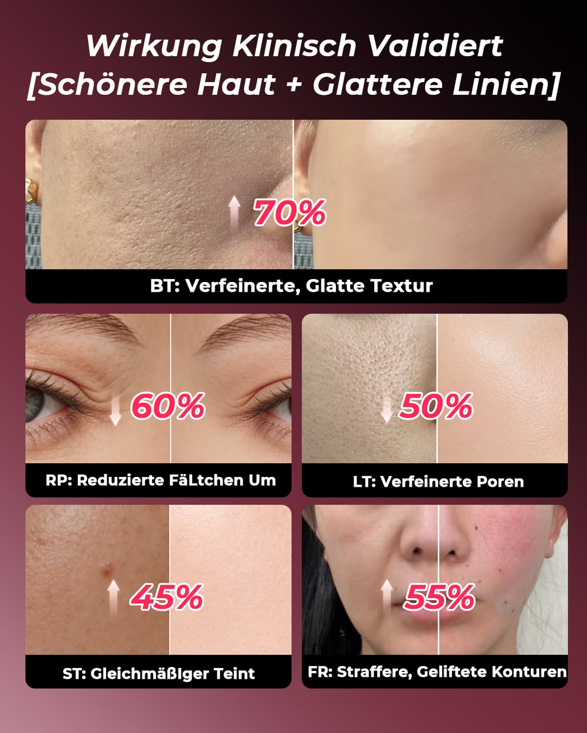 Thumbnail 4 de Gesichtsmassagegerät Radiofrequenz 5-in-1: EMS, LED-Lichttherapie und mehr (Roségold)