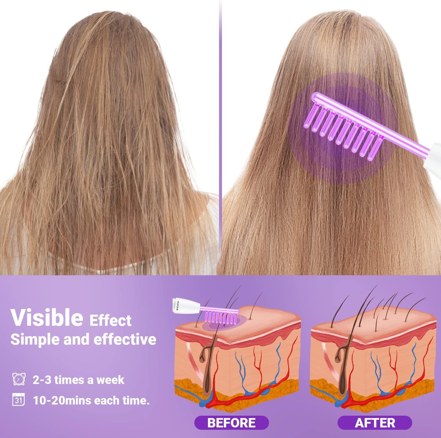 Thumbnail 4 de Bacchetta ad alta frequenza viso professionale UUPAS con 4 tubi ad argon