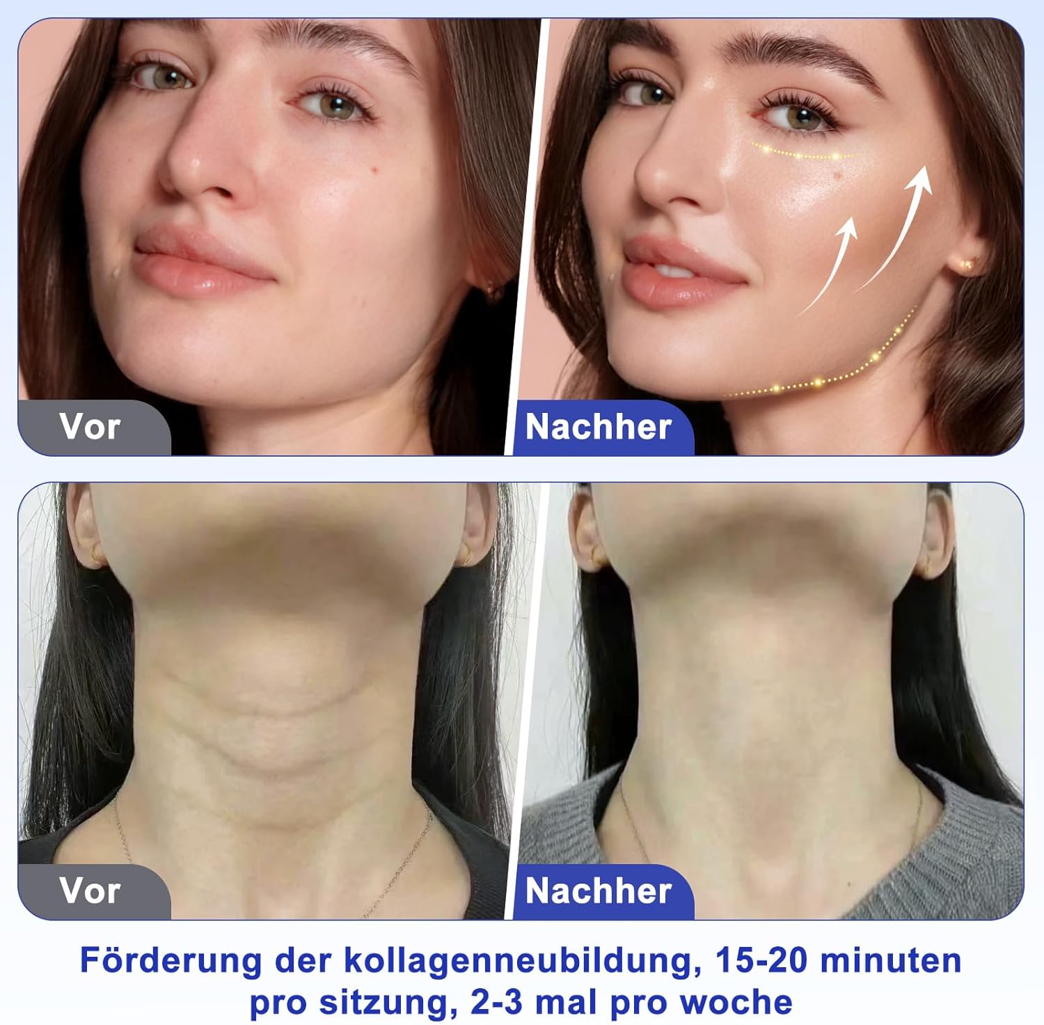 Thumbnail 2 de Ibtyzo 40k Cellulite Massagegerät 4-in-1 mit Ultraschall, RF & Vakuum – für Gesicht und Körper