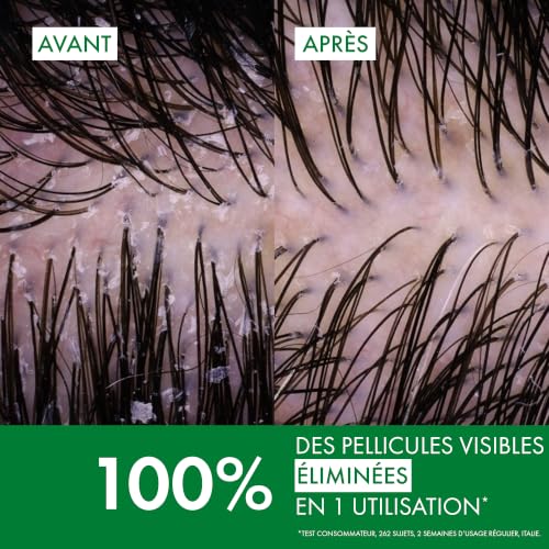 Thumbnail 2 de Vichy Dercos Shampooing Anti-Pelliculaire DS Cheveux Normaux à Gras – Gelée soin capillaire hypoallergénique