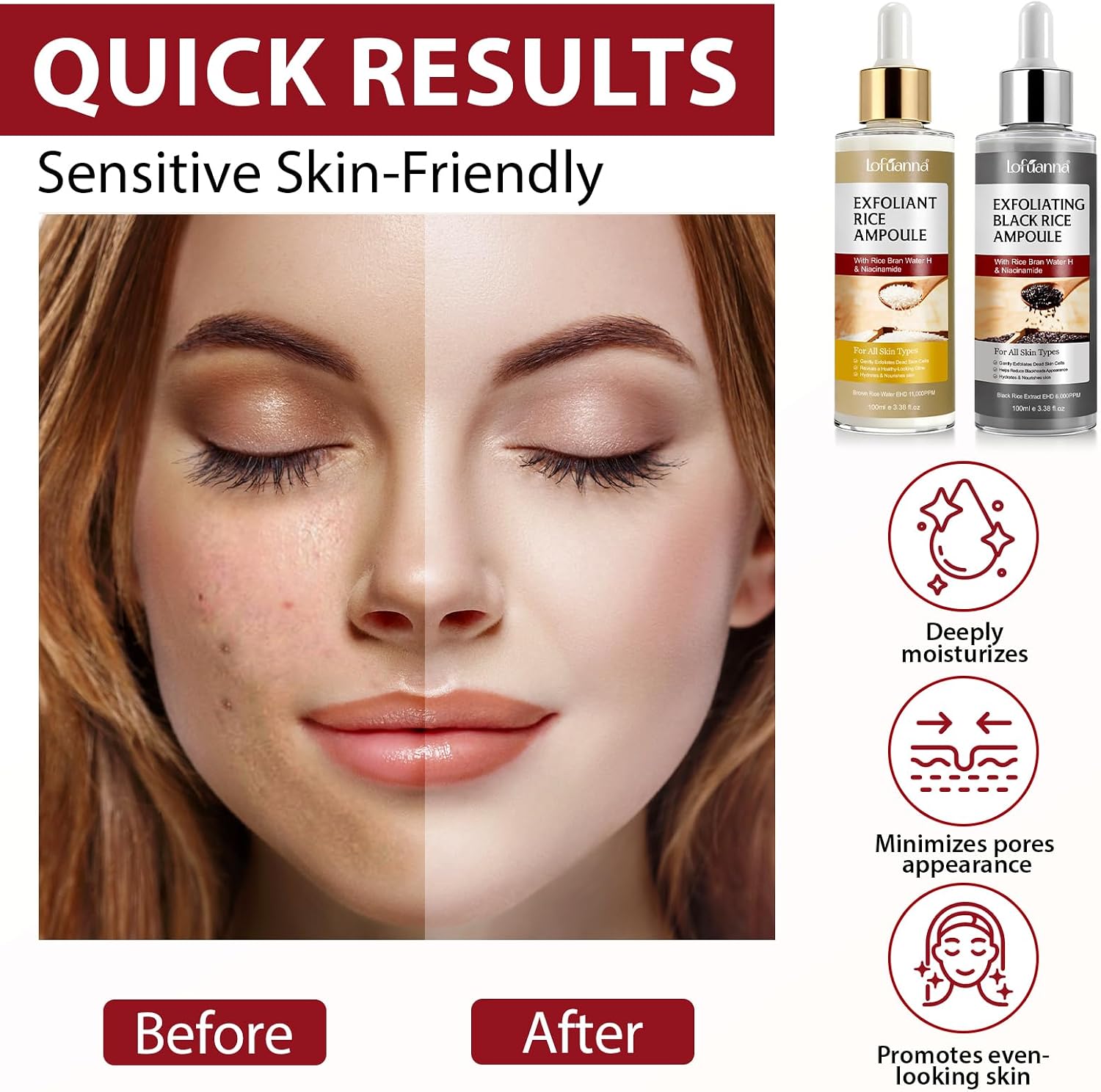 Detalle 2 de Siero Esfoliante al Riso Skincare + Peeling Viso Riso Nero 100 ml cadauno – doppia azione levigante e illuminante