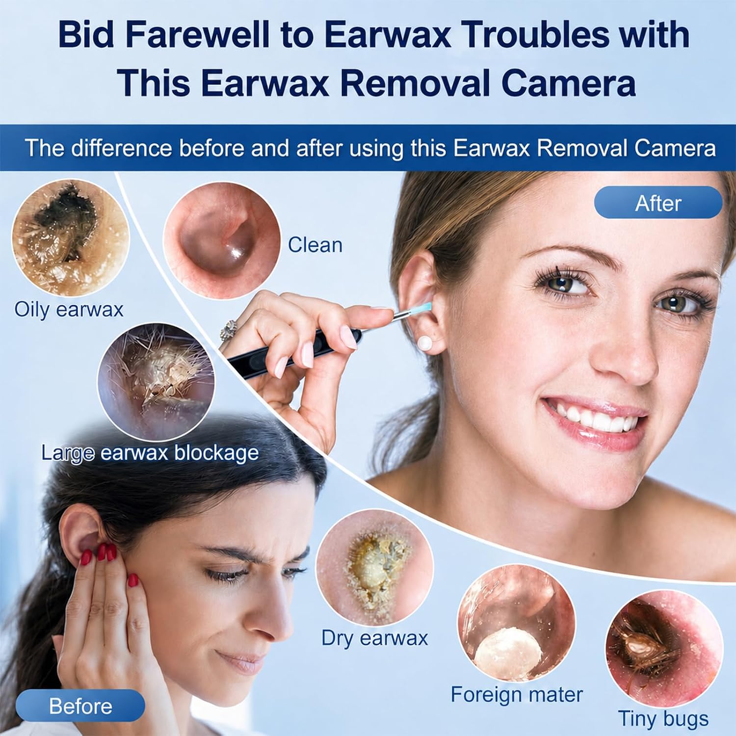 Thumbnail 4 de Healthappy Ear Wax Removal Camera