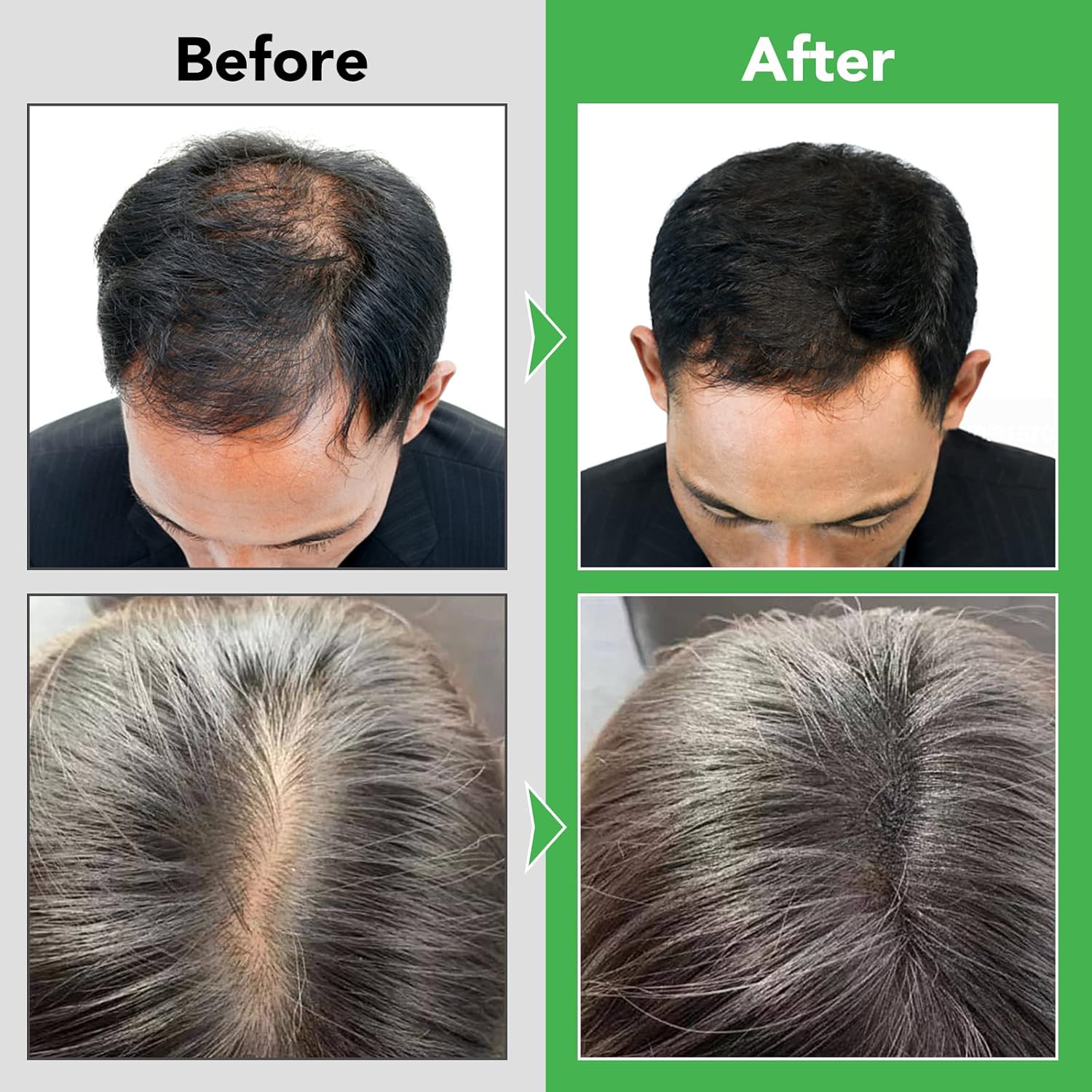 Thumbnail 3 de Rosmarin Shampoo Haarwachstum Rosemary Mint