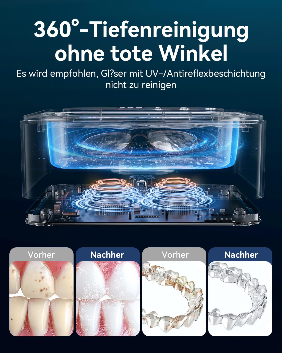 Thumbnail 3 de Ultraschallreinigungsgerät 47 kHz 330 ml