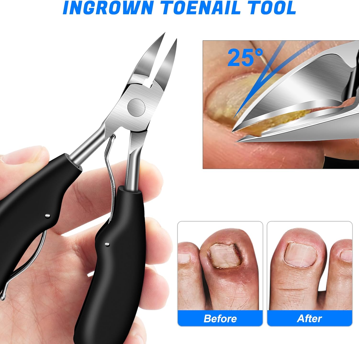 Detalle 2 de 2026 Angled Head Toenail Clippers 37mm, 6PCS ✂