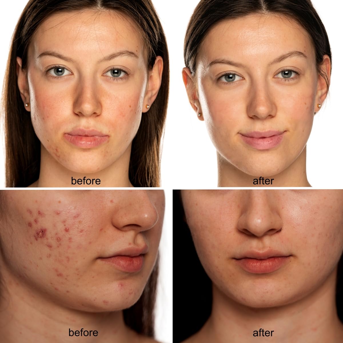Detalle 2 de Avorla Beauty LED mask Multi-wavelength Therapy
