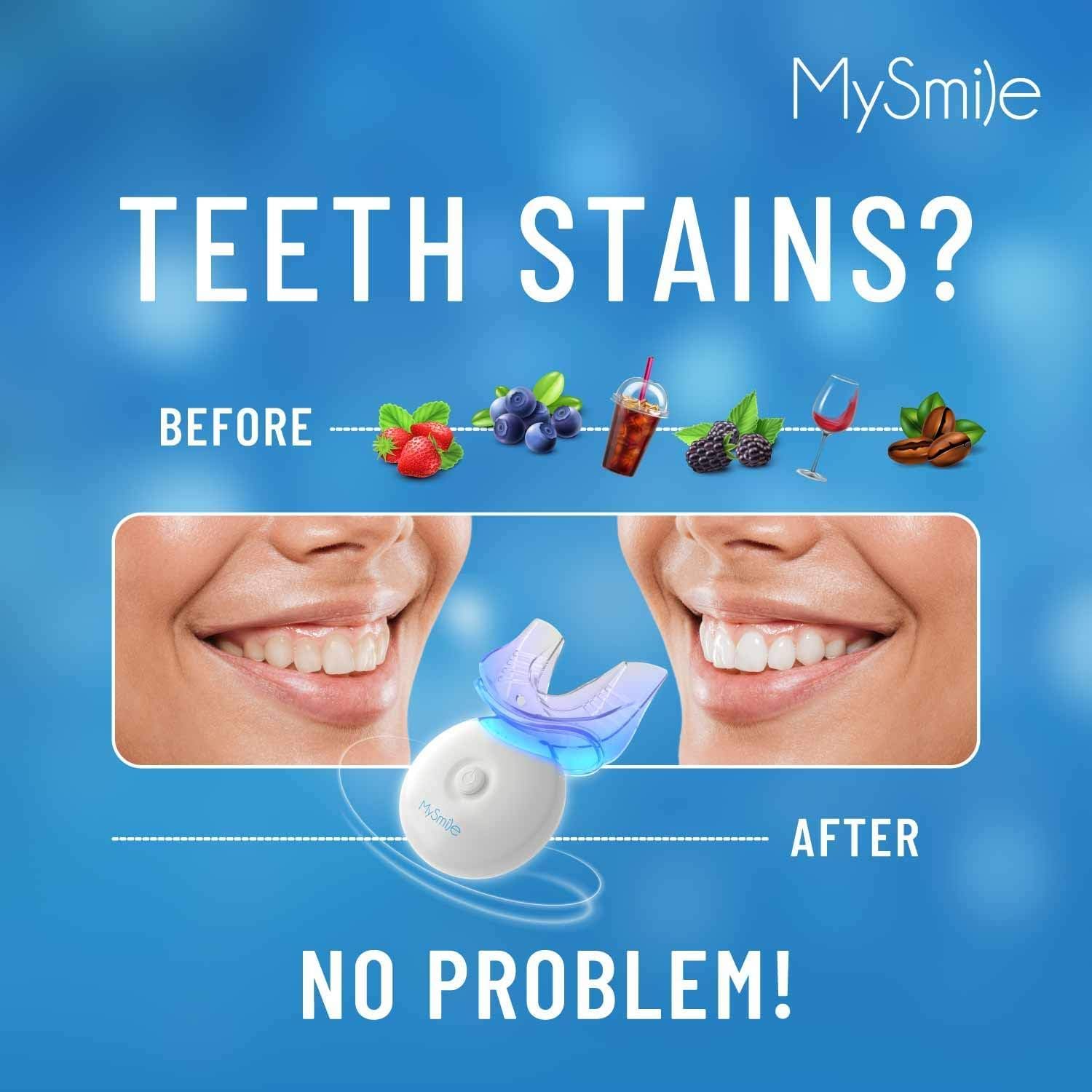Detalle de MySmile Teeth Whitening Kit 35% 🦷