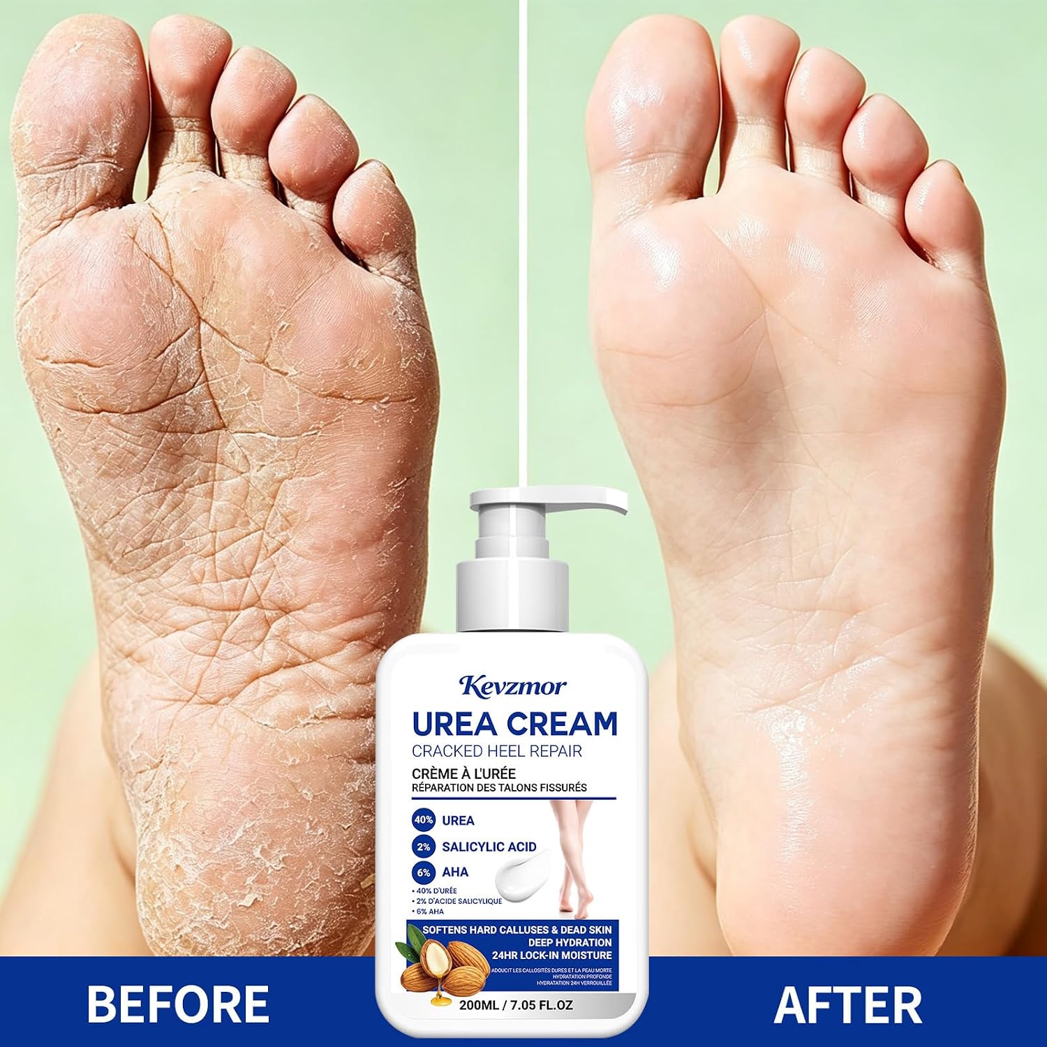 Thumbnail 4 de Kevzmor Foot Cream 200 mL