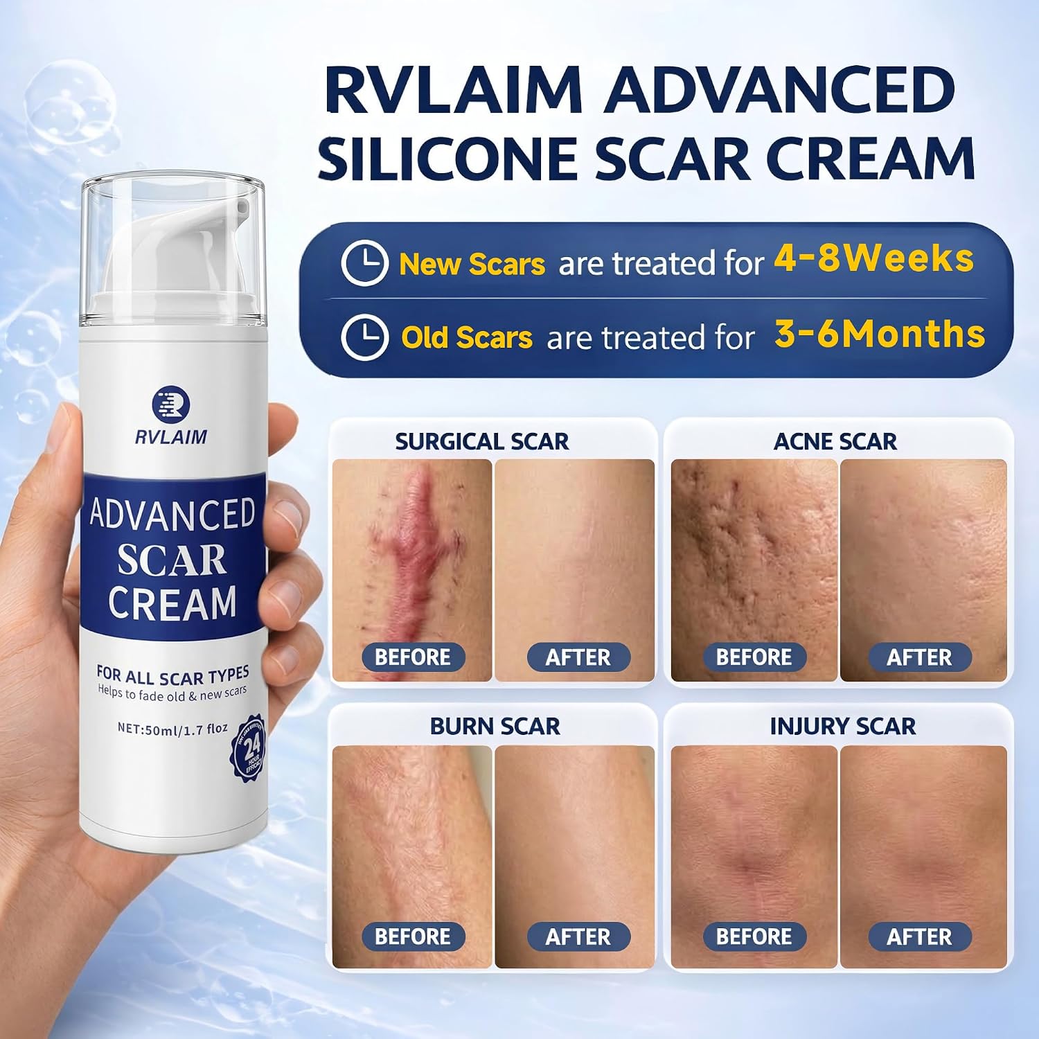 Thumbnail 1 de Rvlaim Silicone Scar Cream, 1.7 oz Non-Greasy Formula