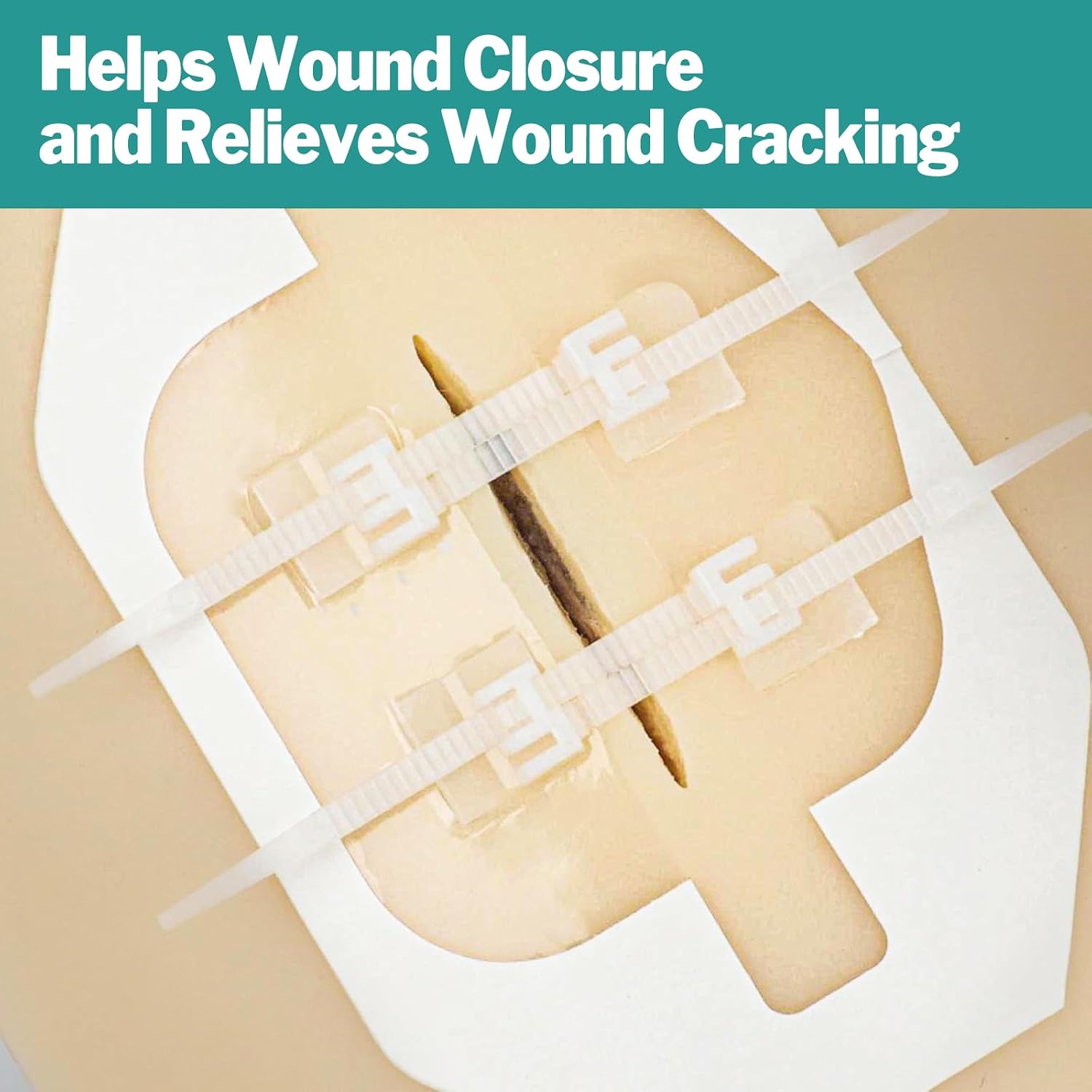 Detalle de AZEN 10 Pack wound closure strips 🩹