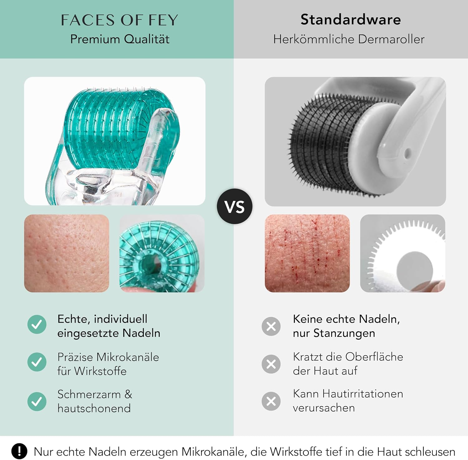 Detalle de Faces of Fey Dermaroller Gesicht 0,5 mm – 192 Nadeln aus Chirurgenstahl