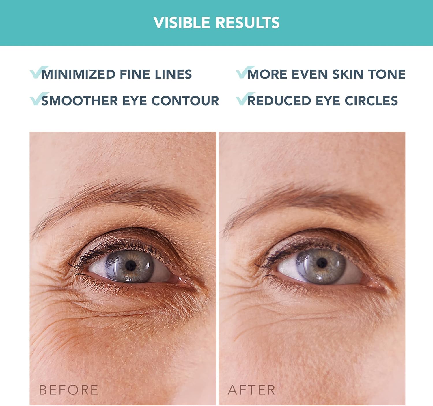 Thumbnail 5 de IRIS Maschera Occhi 60 Patch