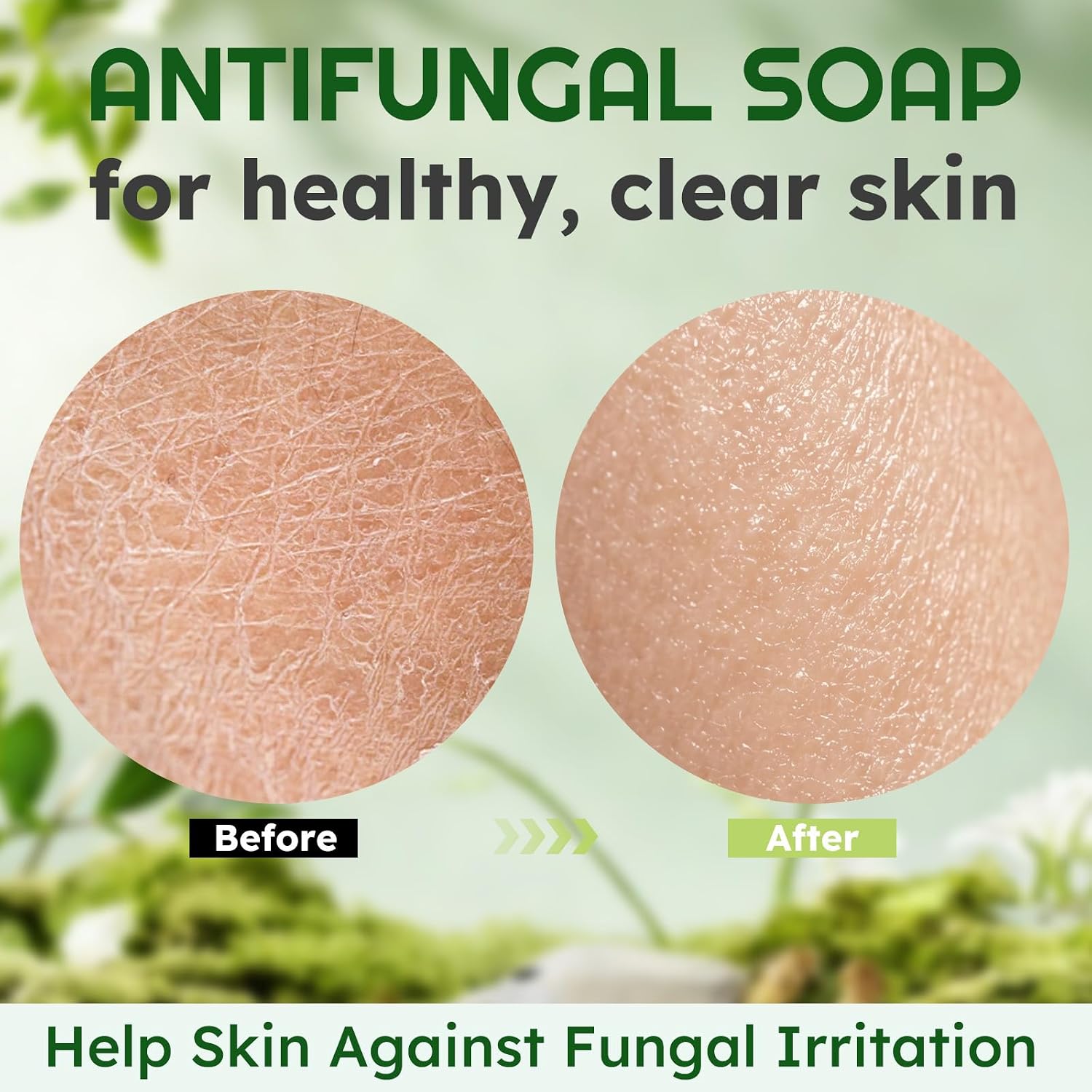 Thumbnail 6 de Oiangna Antifungal Soap Bar, 2-Pack