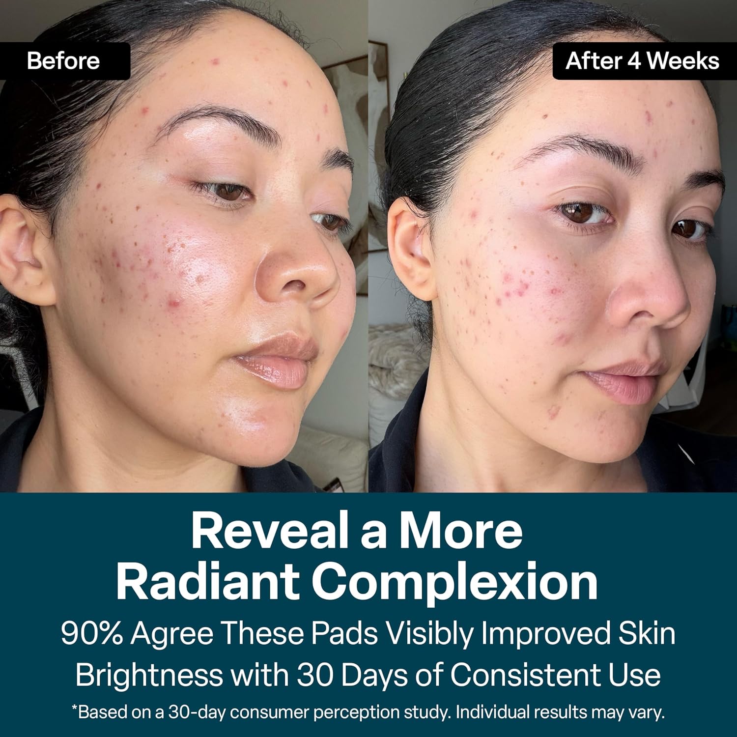 Thumbnail 5 de QRxLabs Glycolic Acid Pads 20%