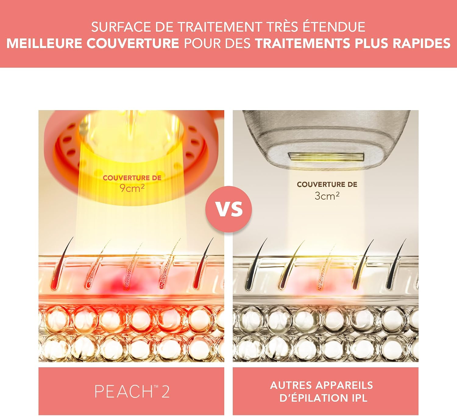 Detalle de FOREO Peach 2 IPL – Épilateur lumière pulsée 10 minutes, confort et couverture optimisés
