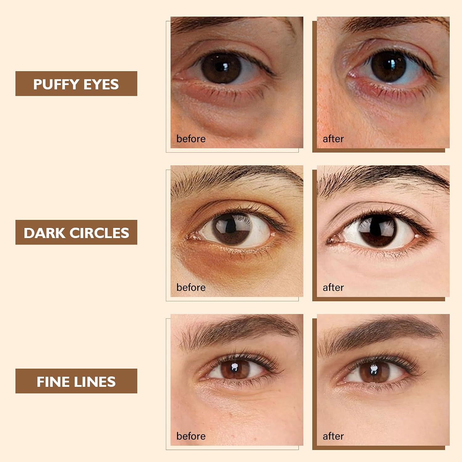Detalle 2 de IREV Caffeine & Peptides Hydrogel Eye Patches, 30 Pairs with Niacinamide