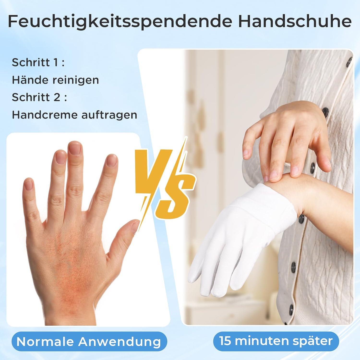 Thumbnail 2 de Donfri 3 Paar Baumwollhandschuhe gegen Neurodermitis (Weiß) – weiche Feuchtigkeitsversorgung, Größe L