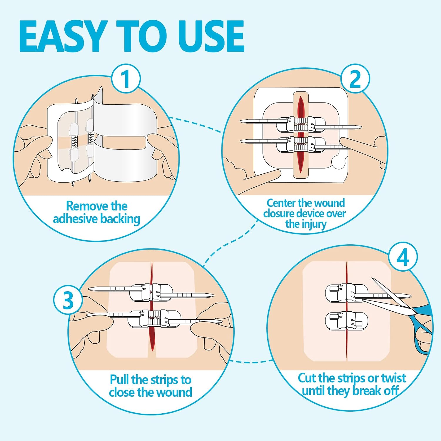 Thumbnail 3 de Senvok Butterfly Laceration Closure Kit with Adjustable No-Sew Closures