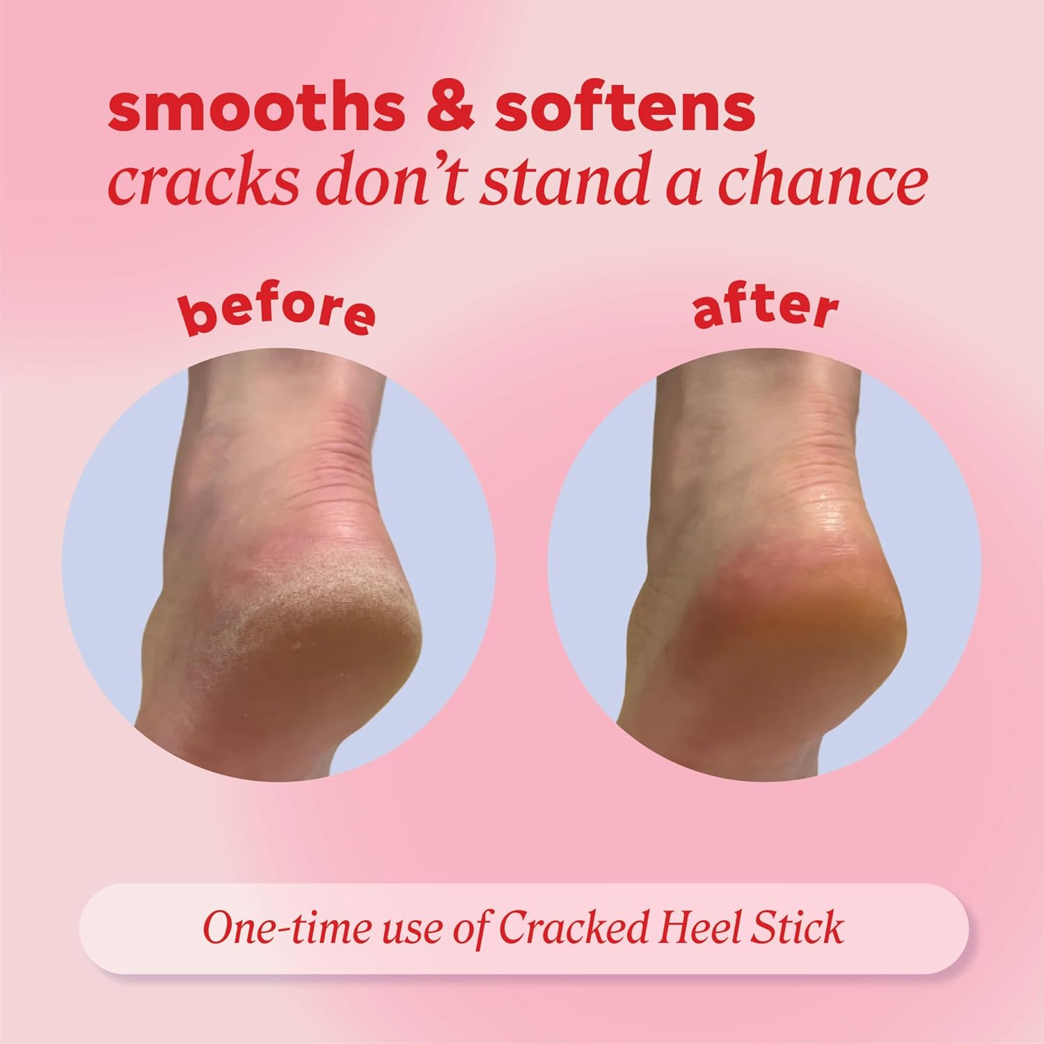 Thumbnail 3 de Onyx Professional Cracked Heel Repair Balm Stick