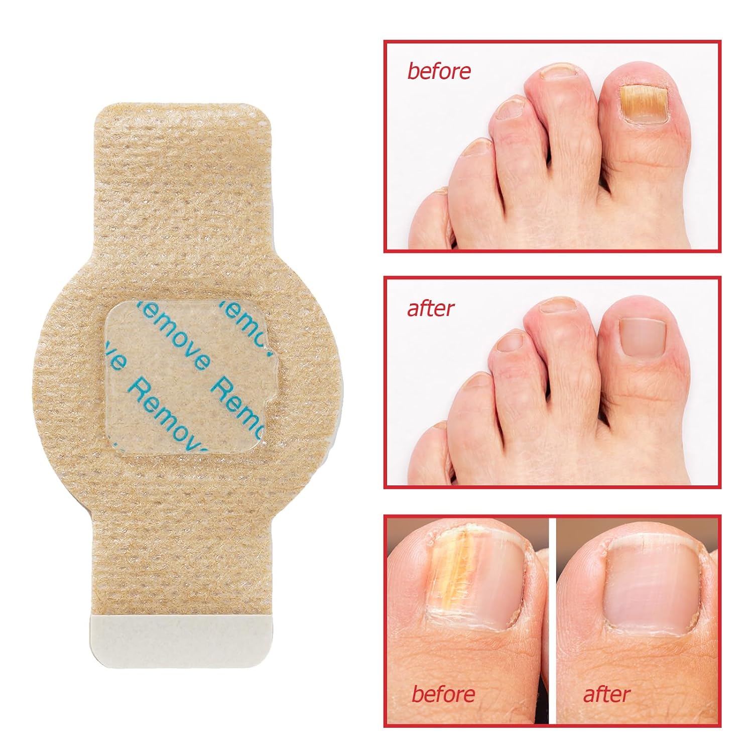 Thumbnail 1 de Nagelpflege-Pflaster für Zehen (21 Stück) – Schonende Pads zur täglichen Nagelpflege