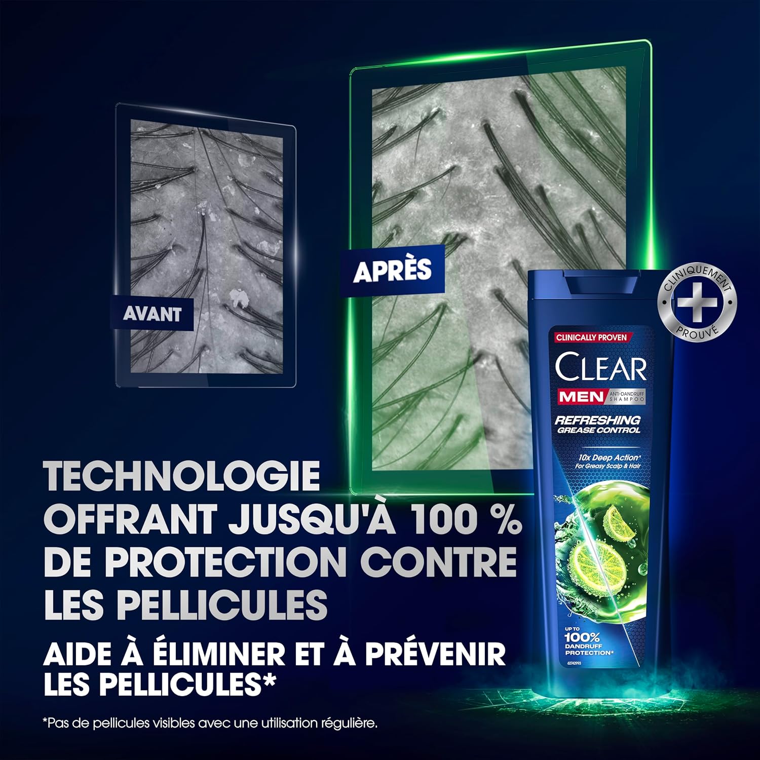Thumbnail 5 de Clear Men Shampooing Antipelliculaire 3x225 ml