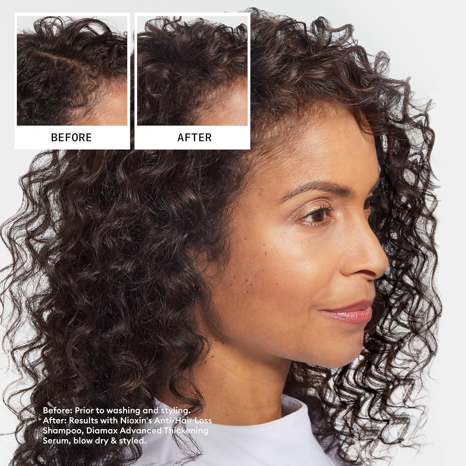 Detalle de Nioxin Professional Anti-Hair Loss Niacinamide Leave-On Scalp Treatment