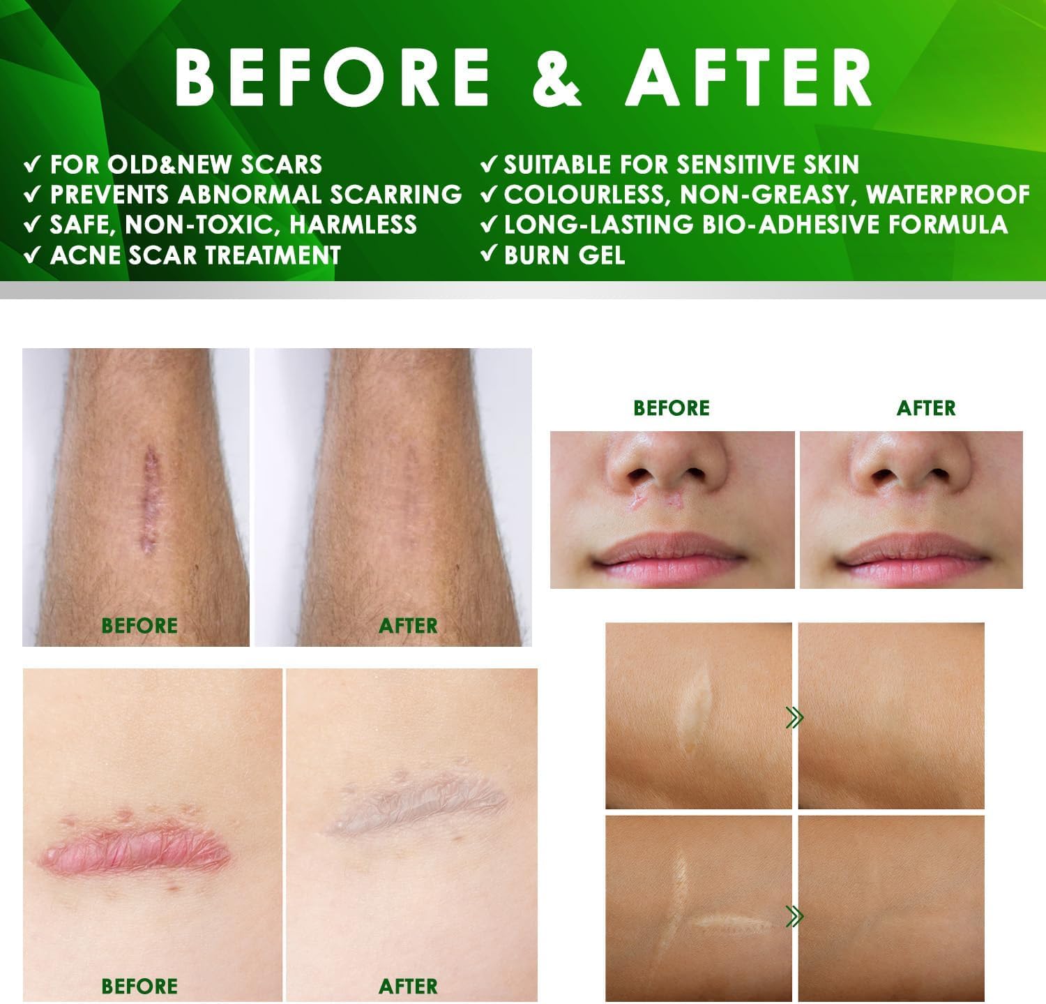 Detalle 2 de Tobcharm Silicone Scar Cream 30 g