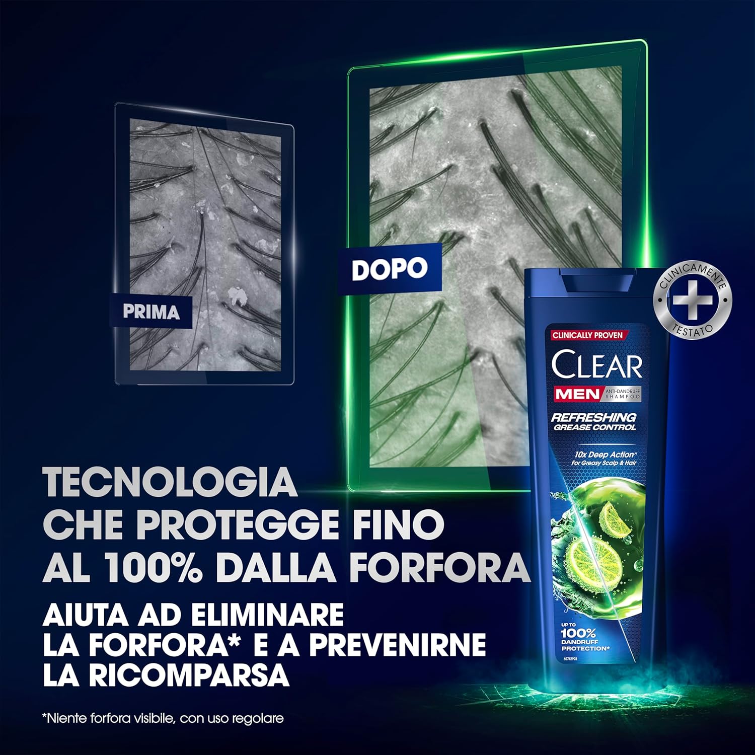 Thumbnail 5 de Clear Men Shampoo Uomo Refreshing Grease Control 3x225 ml: detergente anti-forfora e anti-sebo
