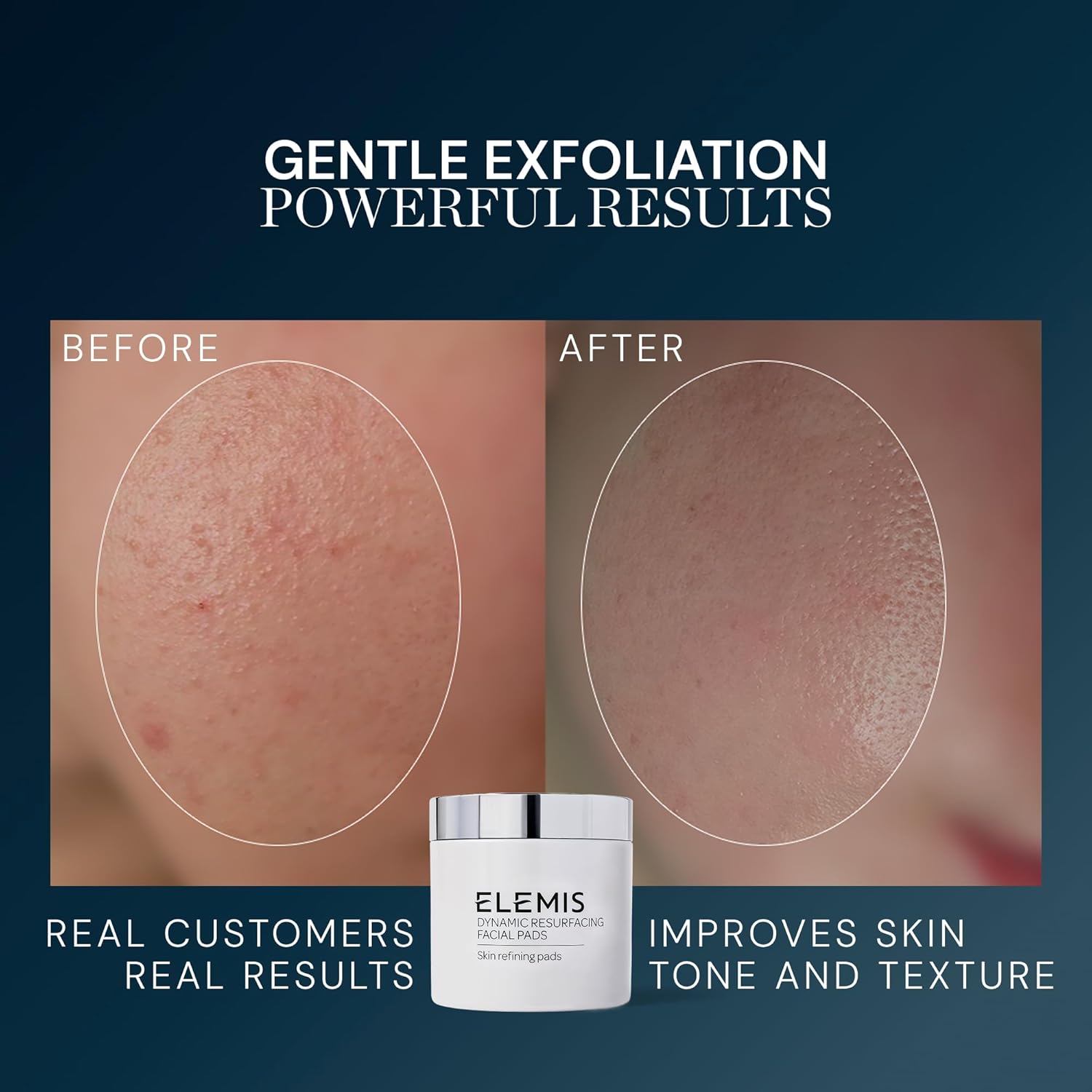 Detalle de ELEMIS Dynamic Resurfacing Facial Pads