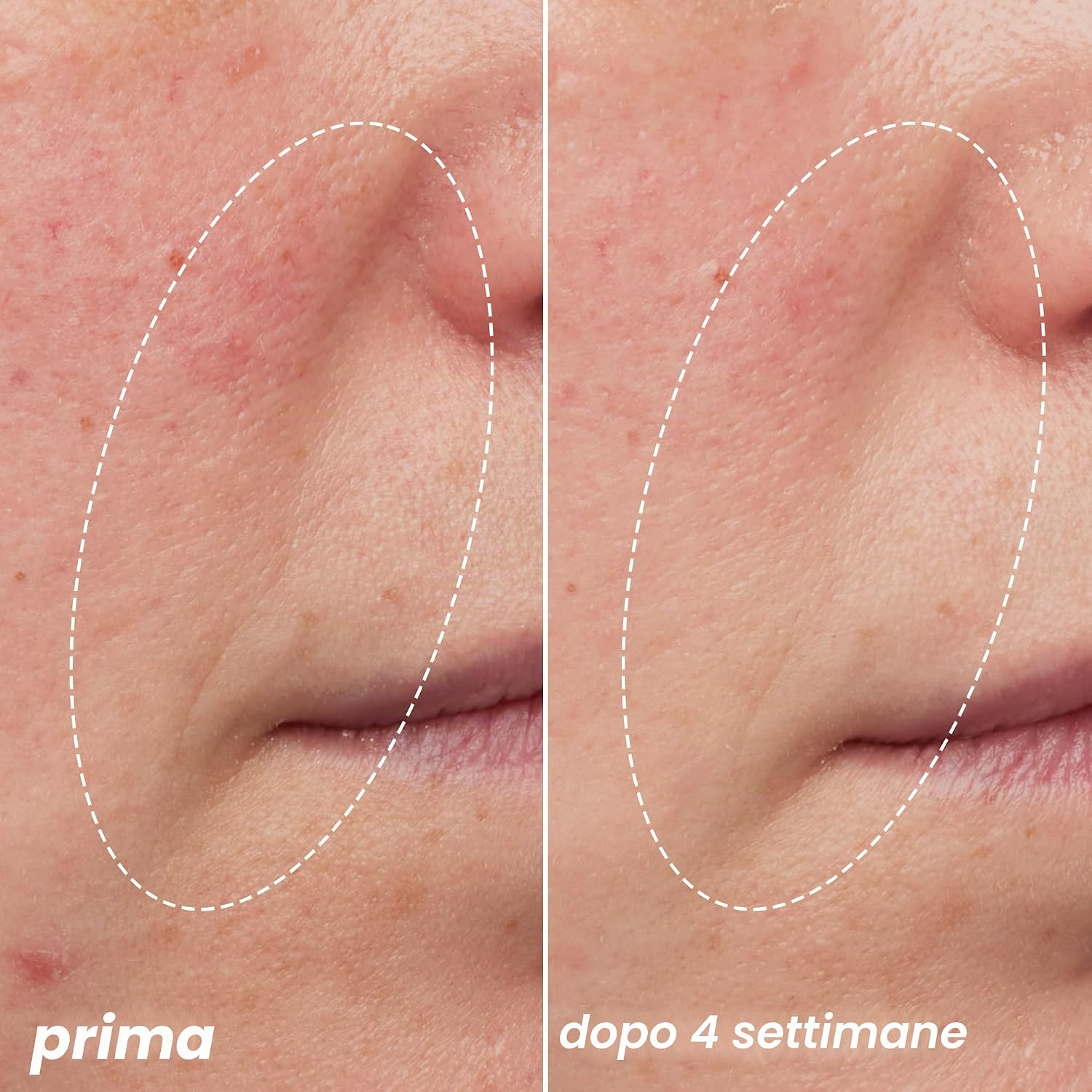 Detalle de e.l.f. SKIN Youth Boosting Blue-ty Sleep Night Oil: olio notte delicato e vegano per un incarnato più luminoso