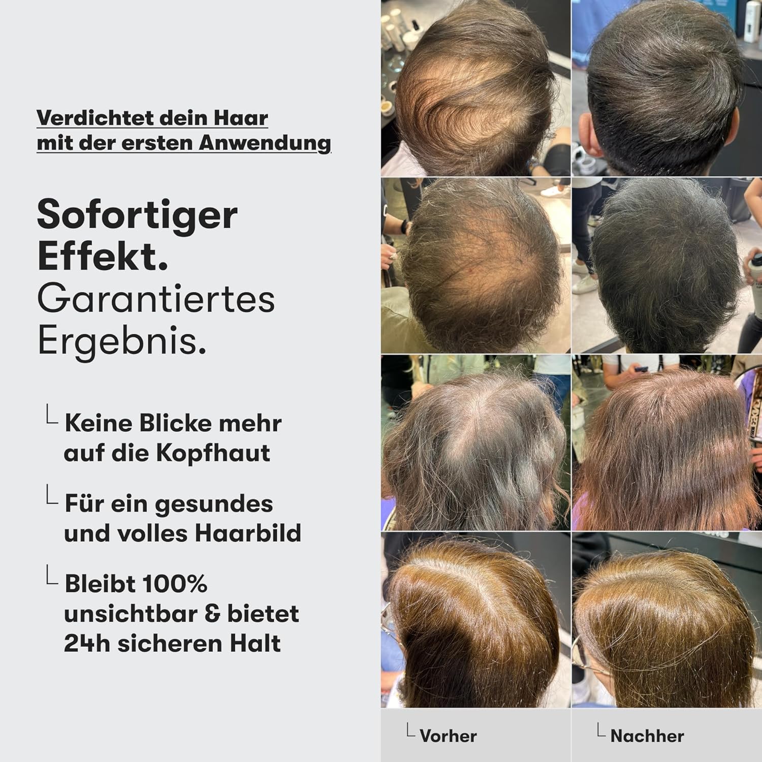 Detalle de O.C. HAIRCARE Streuhaar Haarverdichtung Mittelbraun