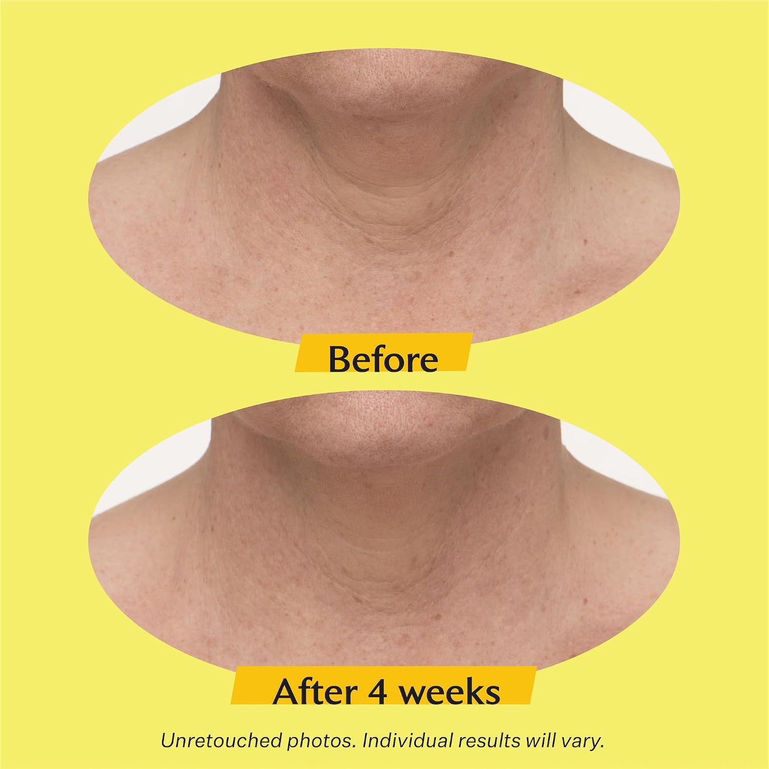 Thumbnail 6 de StriVectin neck cream tighten and lift