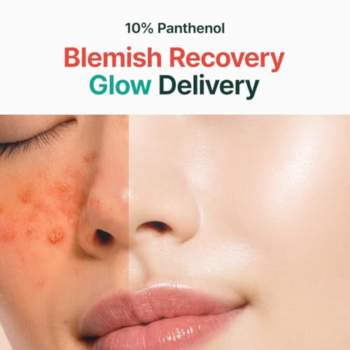Thumbnail 2 de PURITO Post-Acne Recovery Glow 100ml