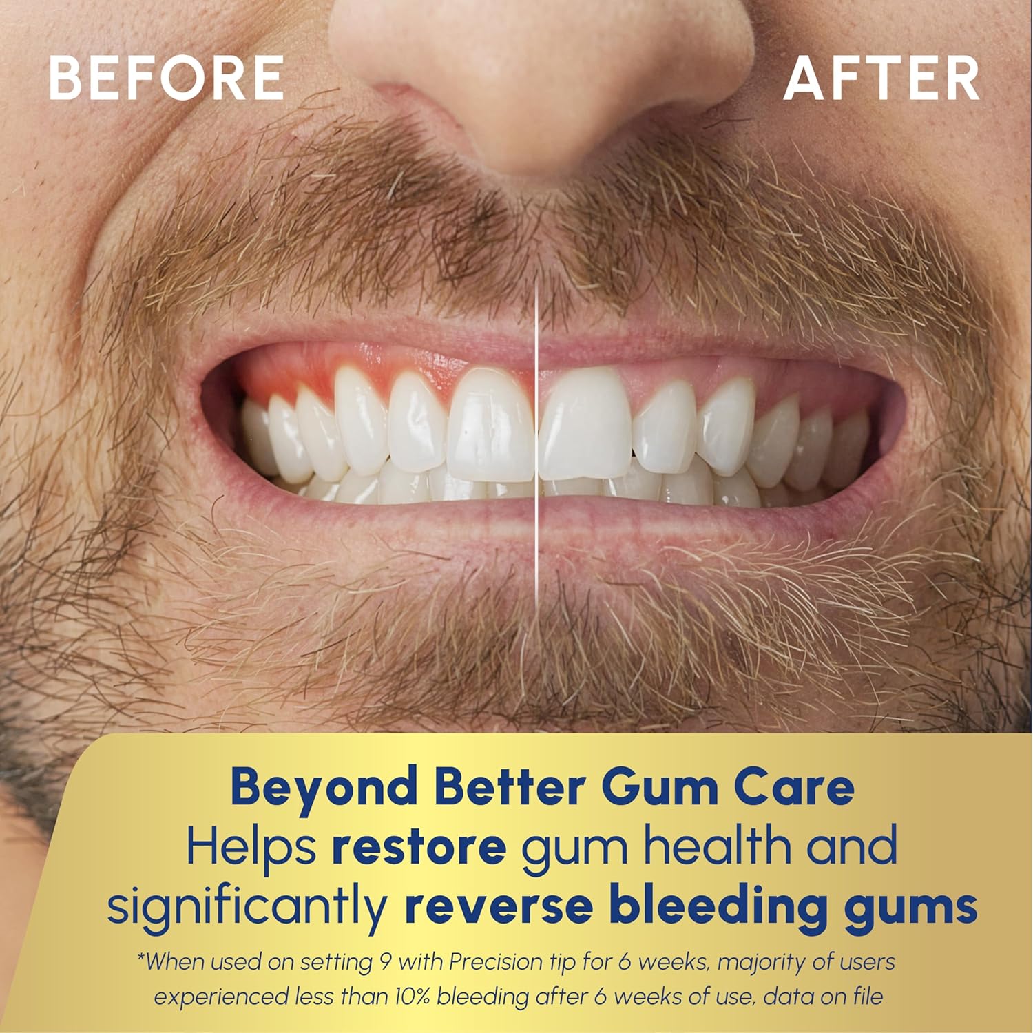 Thumbnail 5 de Waterpik Promax Dental Water Flosser (WF-23) with SmartAdvance Mode, ADA Accepted