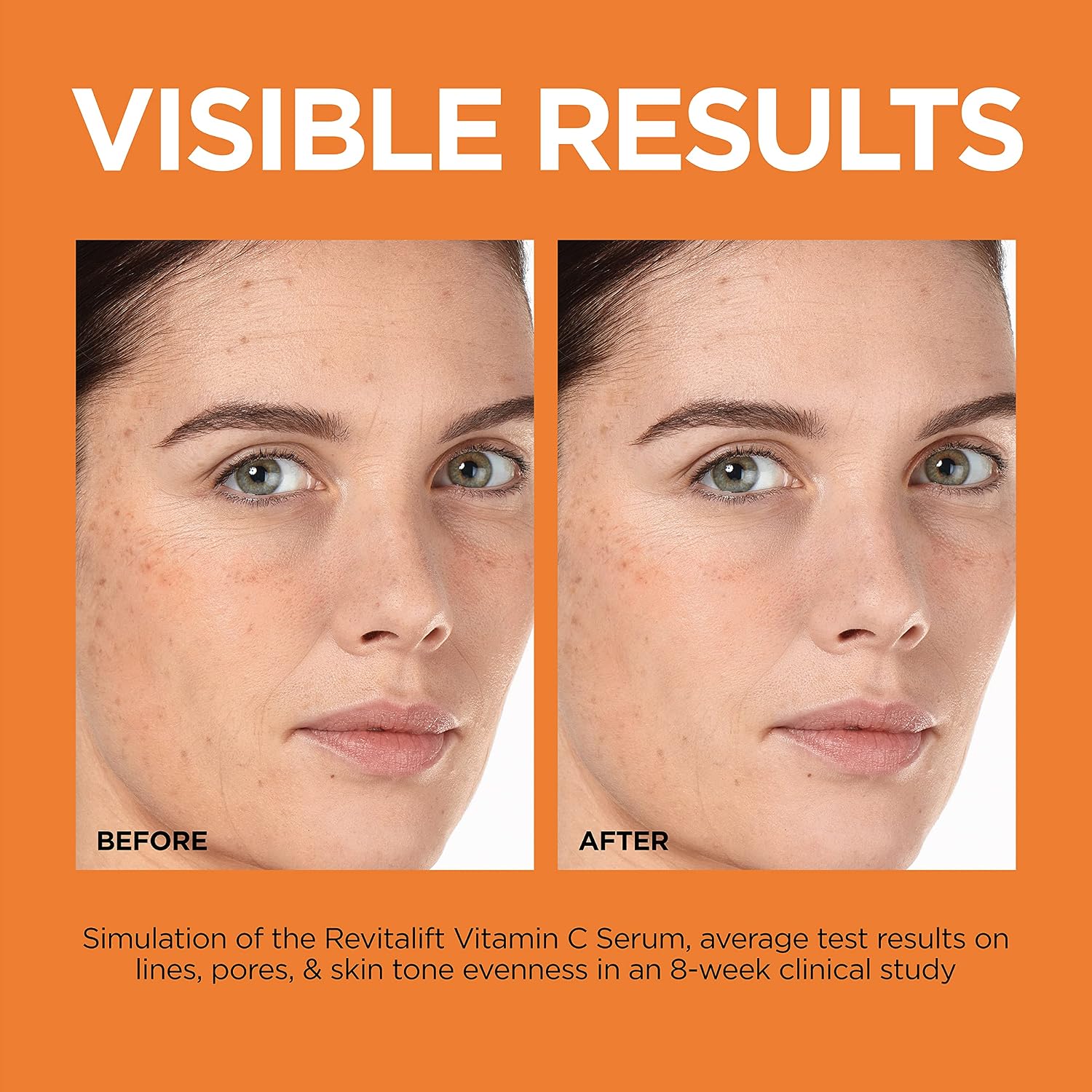 Thumbnail 4 de L'Oréal Paris Revitalift 12% Pure Vitamin C Serum, 1 oz with Vitamin E
