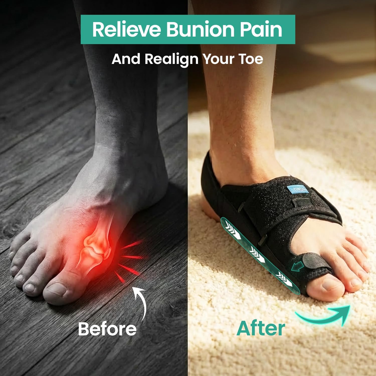 Thumbnail 3 de RFAQK Bunion Corrector Kit, 11-Piece Toe Separators and Splints