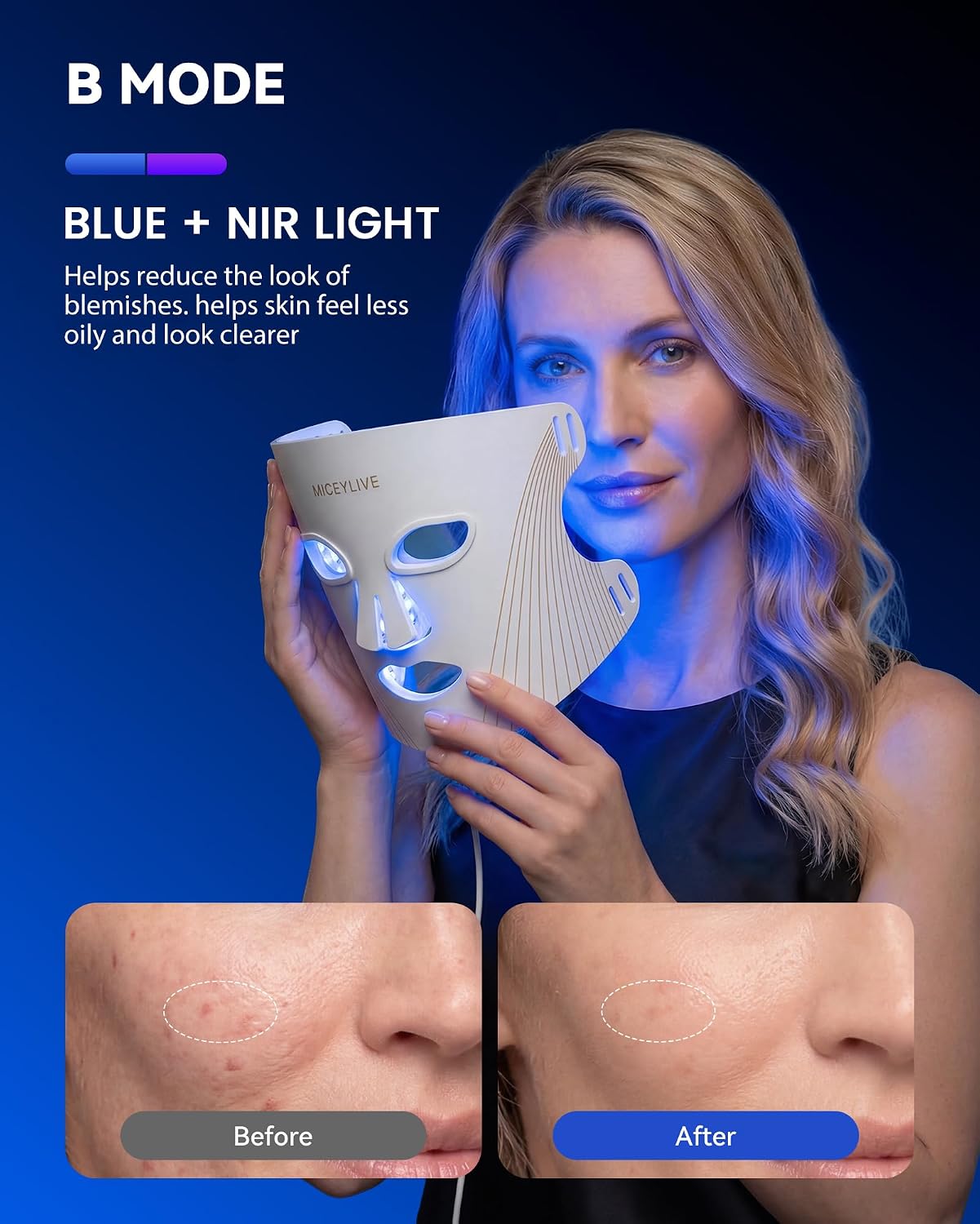 Detalle 2 de MICEYLIVE E106A Red Light Therapy Mask, Silicone, 3 Light Modes