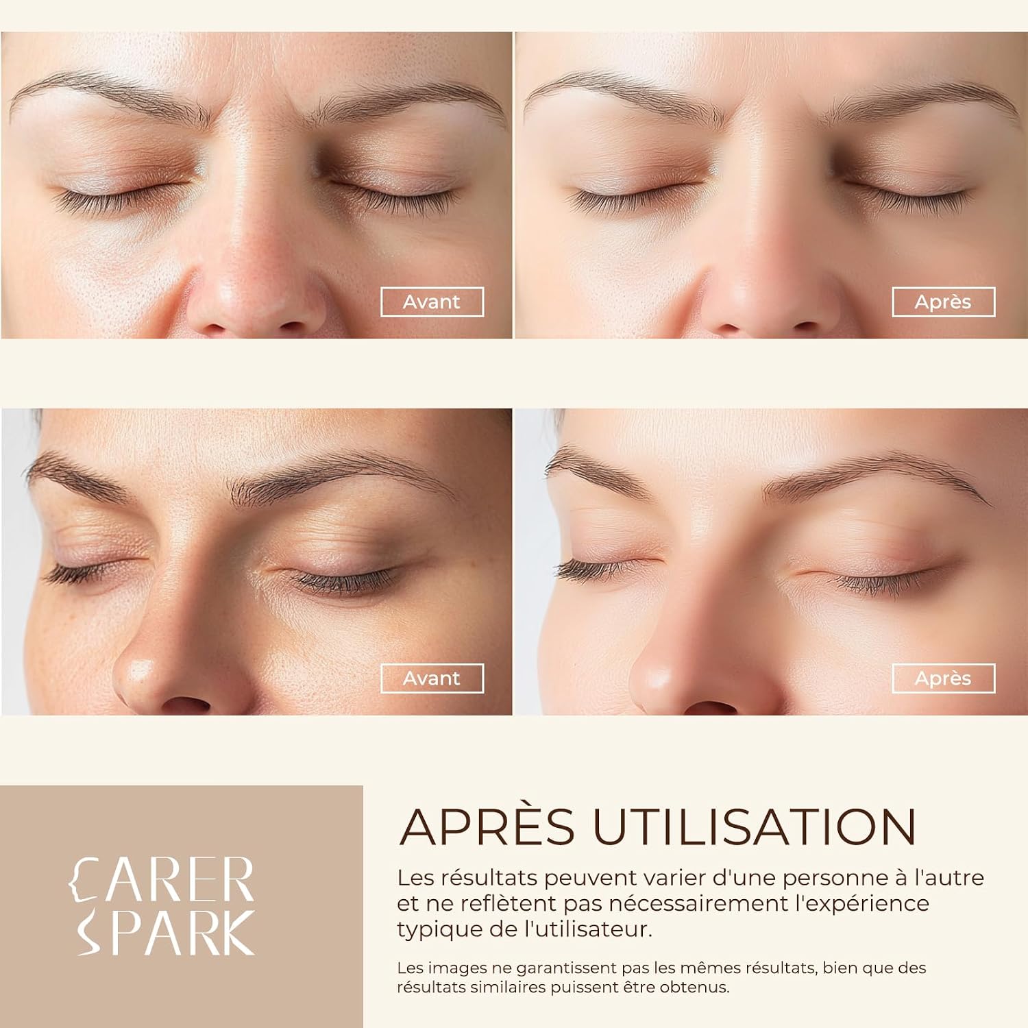 Thumbnail 4 de CARER SPARK Épurateur de Peau Ultrasonique – Spatule visage 5-en-1 avec EMS, ions et lumière rouge/bleue