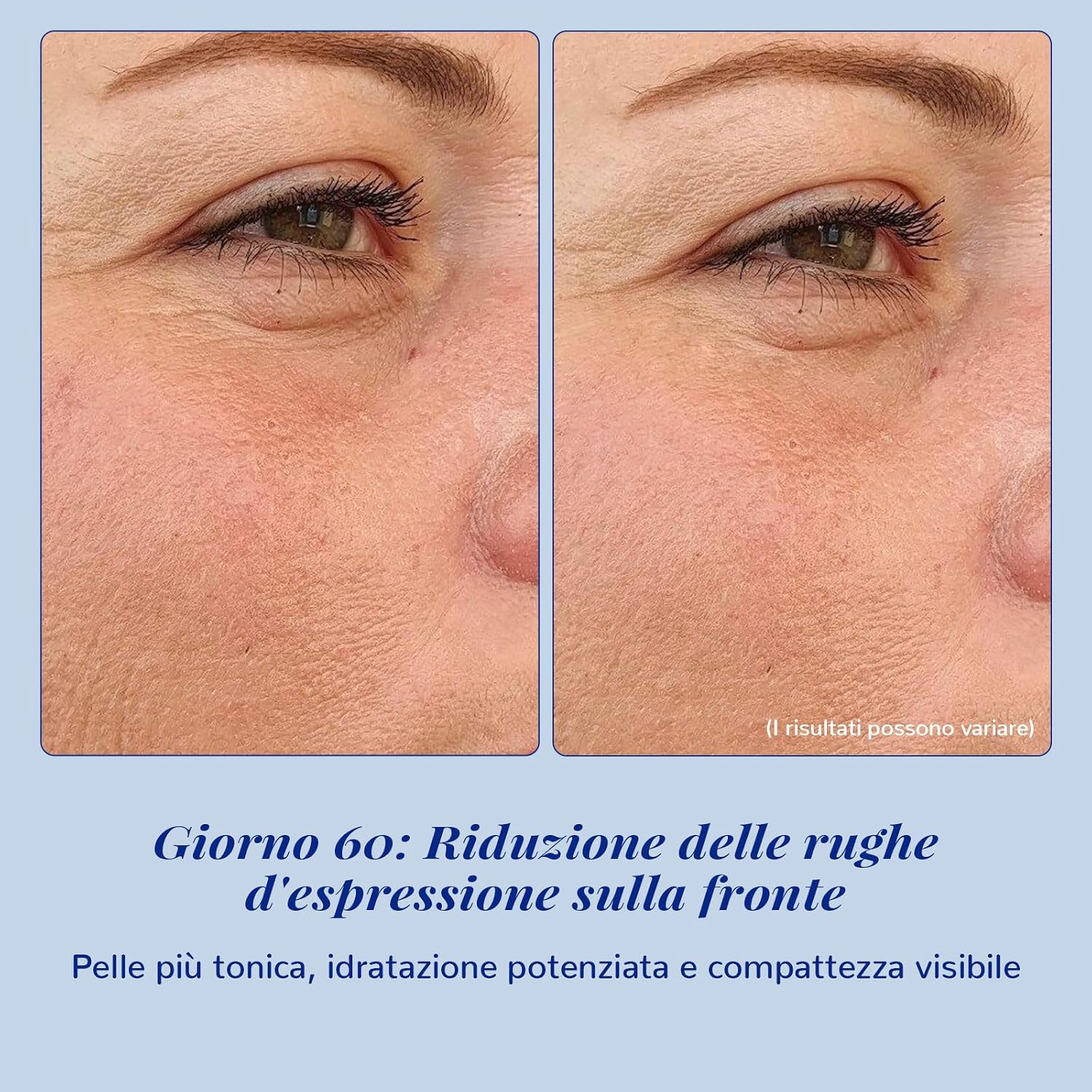 Detalle 2 de ANAiRUi Matrixyl 3000 siero viso 30 ml