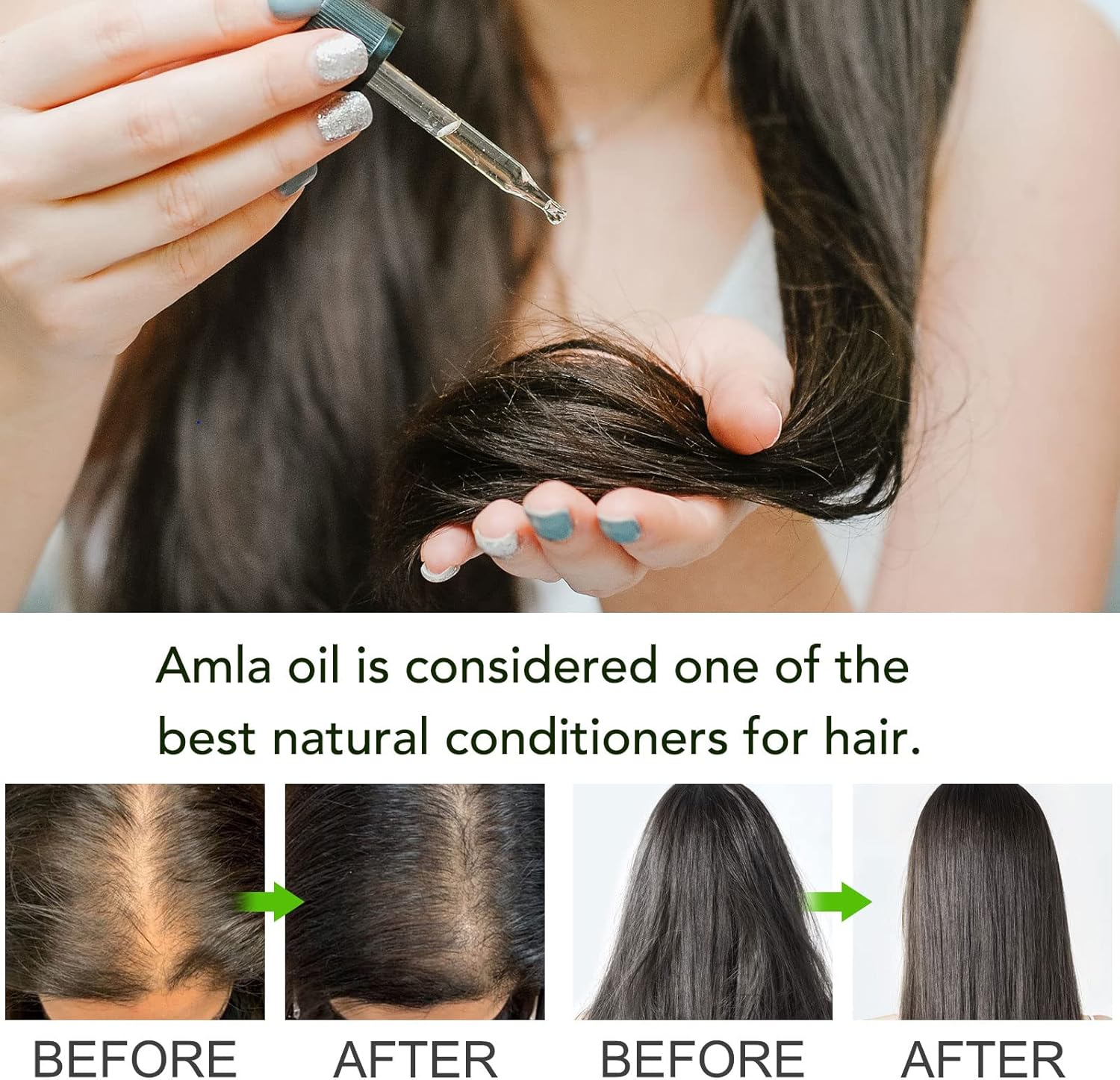 Detalle de Amla Oil 60ML – Huile d'Amla pour cheveux fortifiés et vitalité, lutte contre la perte et grisaille