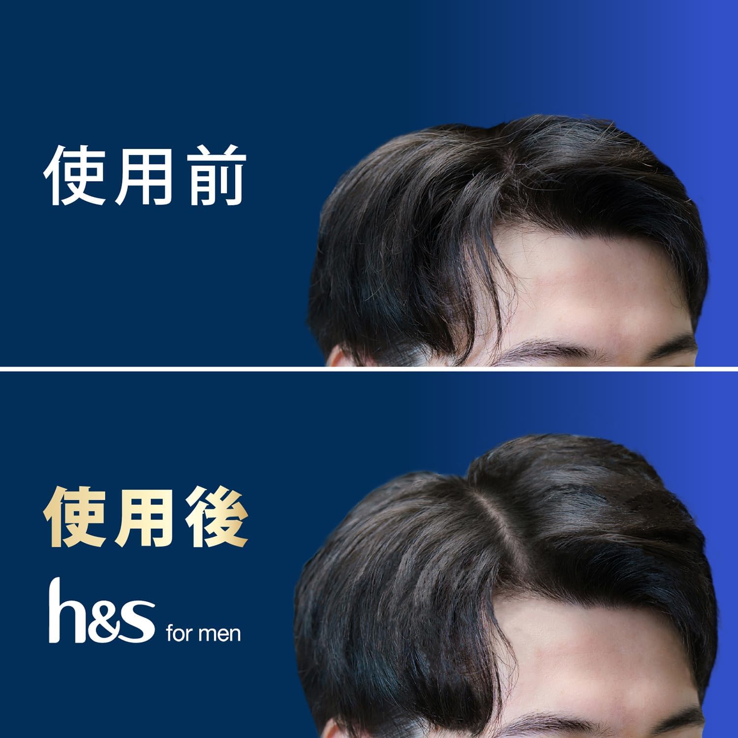 Thumbnail 3 de h&s for men ボリュームアップ薬用シャンプー＆コンディショナーセット 350mL+350g ポンプ