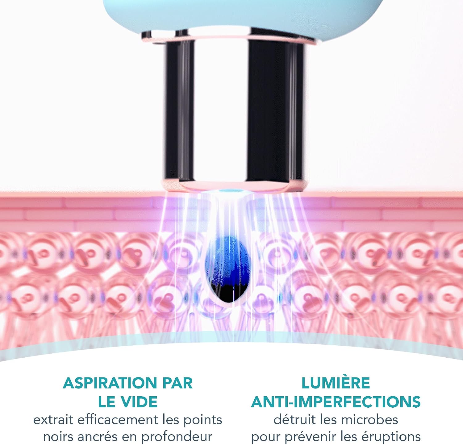 Detalle de FOREO KIWI Extracteur De Points Noirs – Aspirateur De Pores Avec Lumière