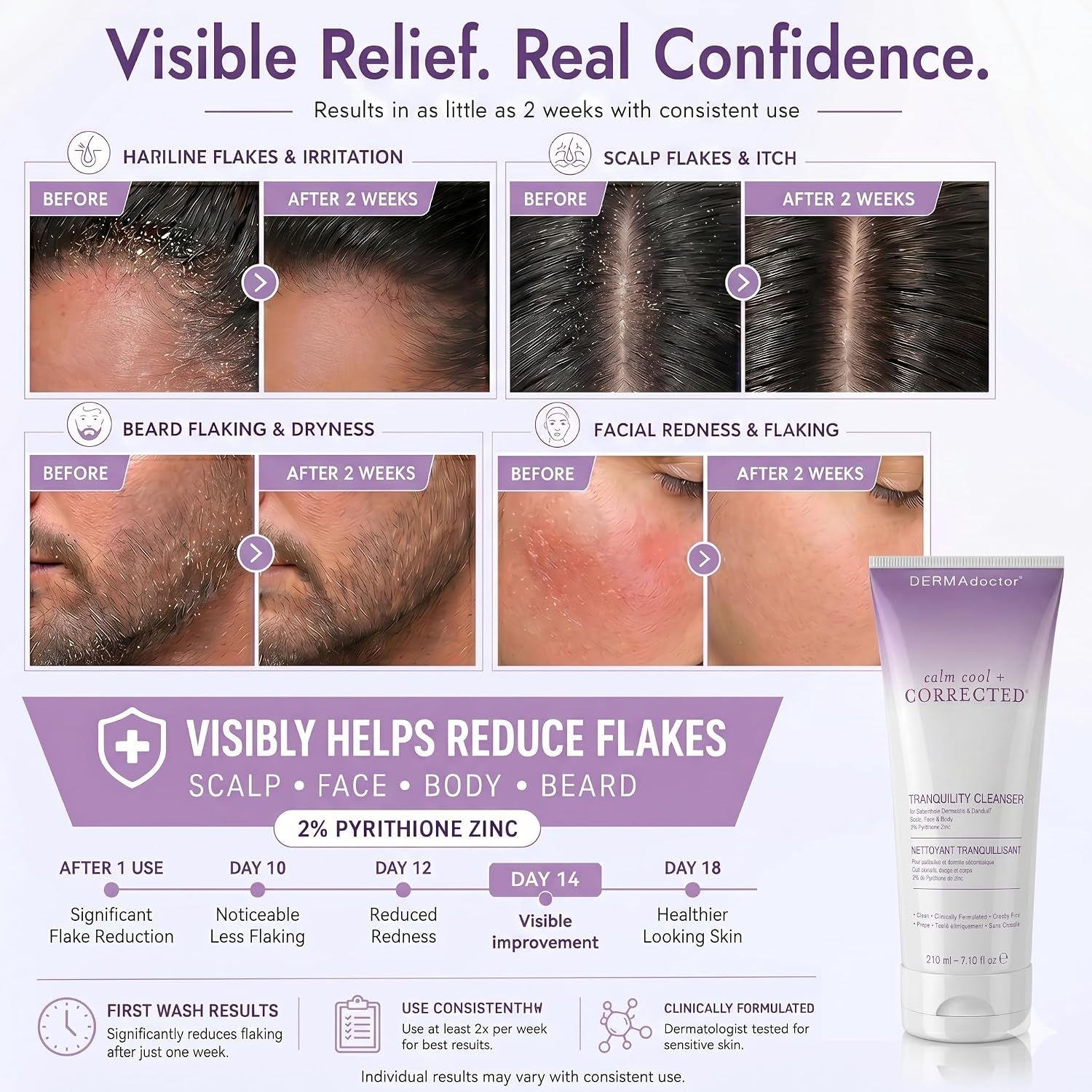 Thumbnail 1 de DERMAdoctor 2% Pyrithione Zinc Tranquility Cleanser: A Multi-Use, Over-the-Counter Solution for Seborrheic Dermatitis and Dandruff
