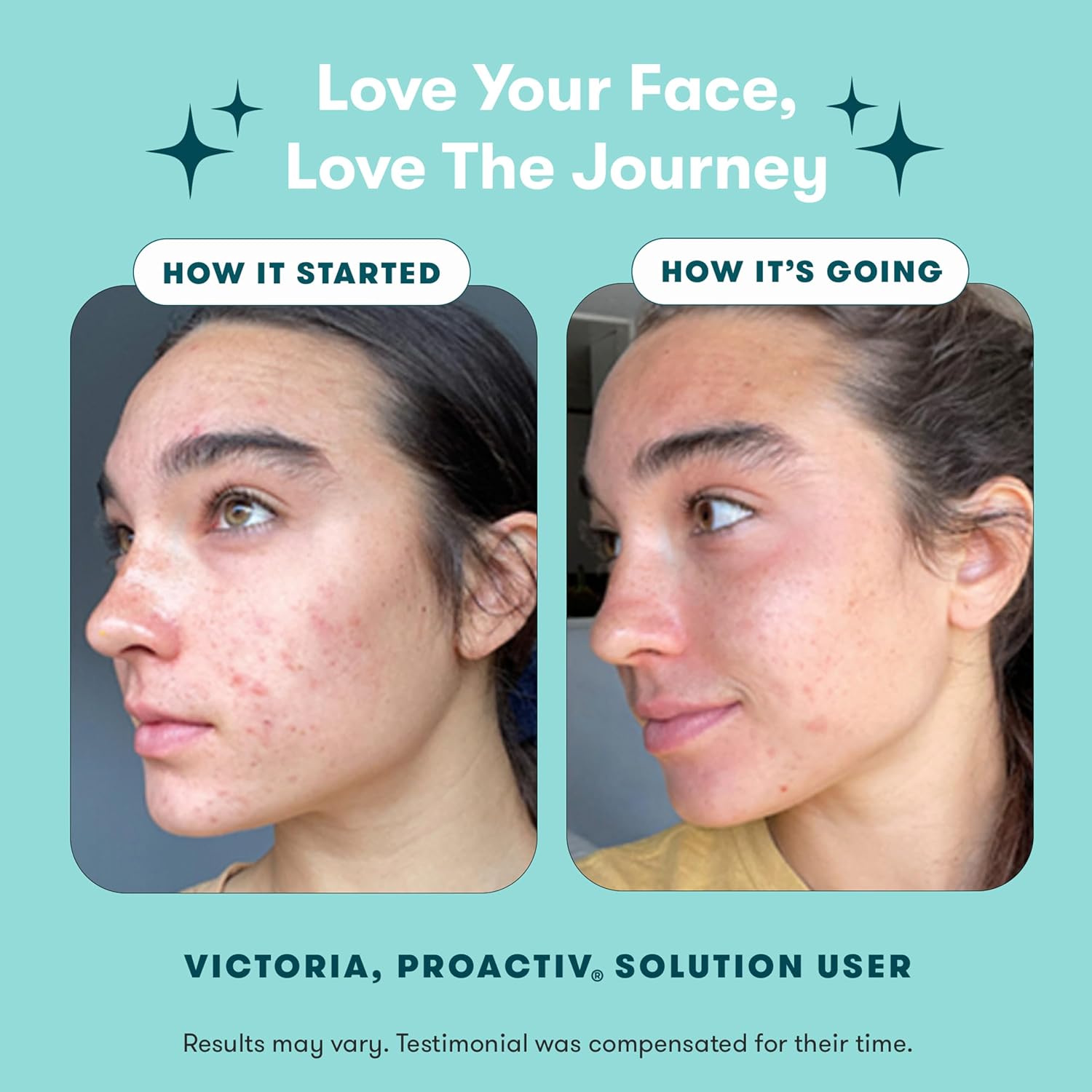 Detalle de Proactiv Solution Acne Treatment Kit, 30-Day 3-Step Routine with 2.5% Benzoyl Peroxide