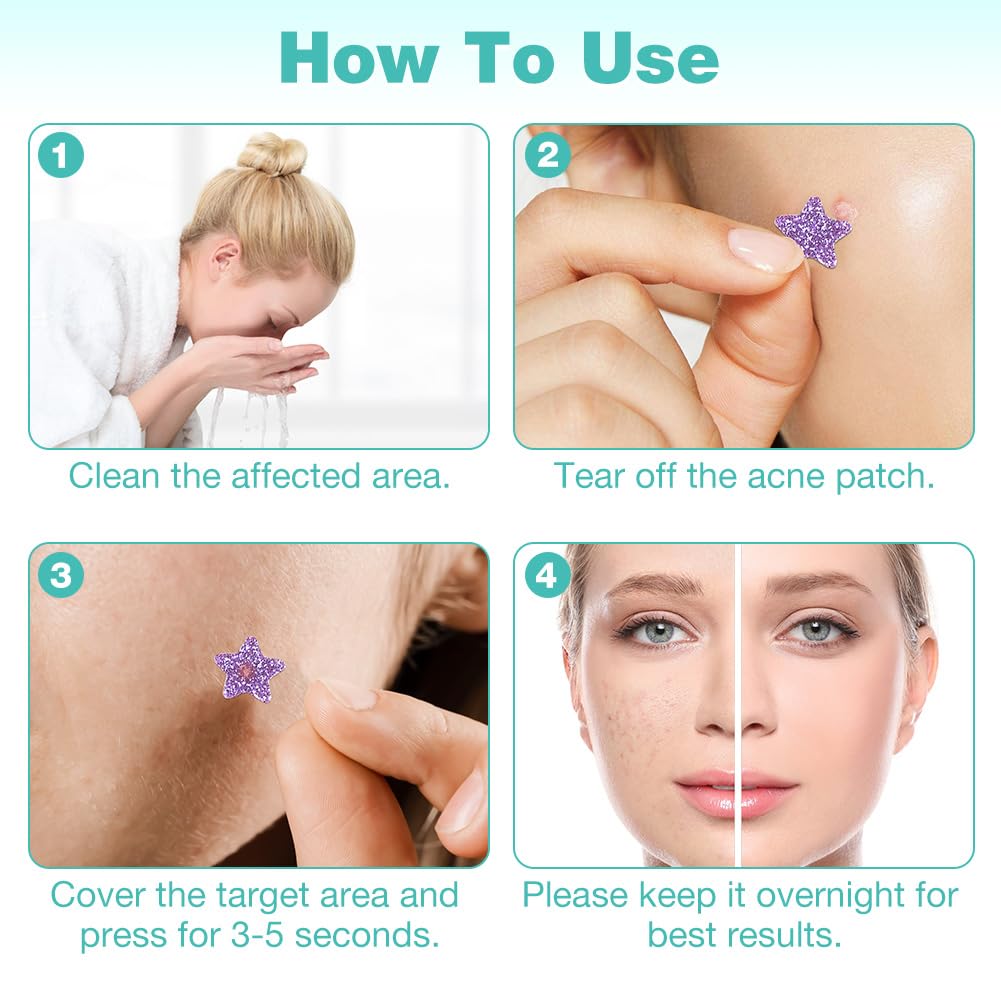 Thumbnail 4 de BUTBU 400 Sternförmige Pimple Patches – Hydrokolloid, 2-in-1 Akne Pflaster mit Salicylsäure, Teebaumöl & Centella Asiatica