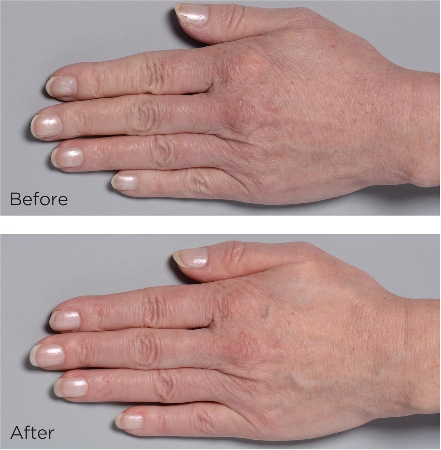 Thumbnail 2 de Perricone MD Cold Plasma Plus+ Hand Treatment Cream — crème mains au plasma froid, 59 ml